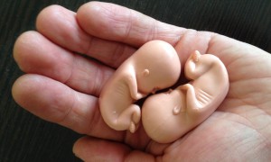 2 эмбриона на ладошке